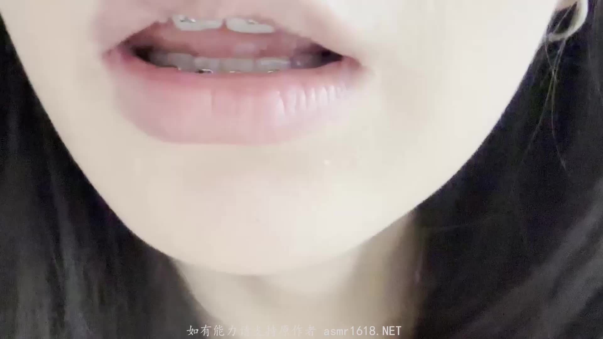 #布鲁比呐呐 牙套妹的口腔检查